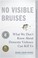 No Visible Bruises: What We Don't Know About Domestic Violence Can Kill Us cover